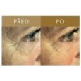 FORGET ABOUT AGE Instant Wrinkle Eraser