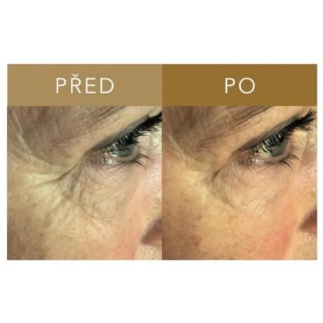 FORGET ABOUT AGE Instant Wrinkle Eraser